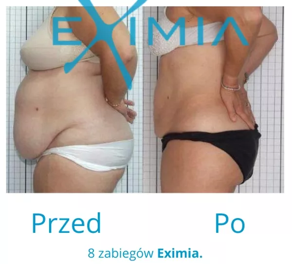 eximia-11