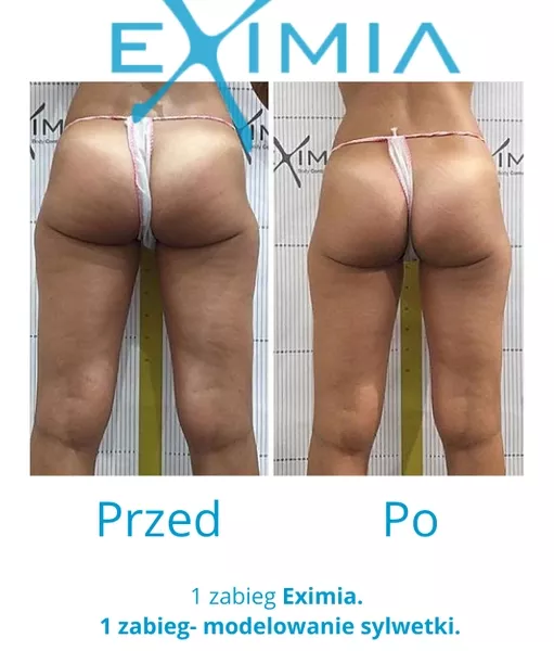 eximia-15